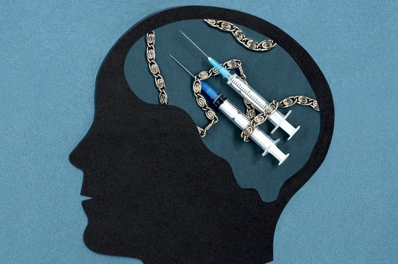 Thought insertion is a belief that one's thoughts are made by someone else. Picture of a brain with syringes insight