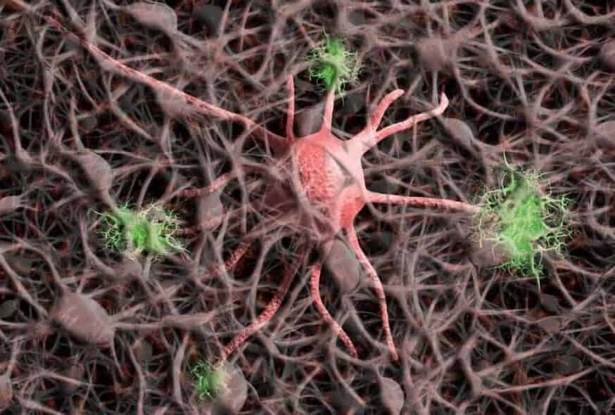 The neurobiology of the brain is one of the factors influencing the onset of depression. The picture shows a neuron in the human brain